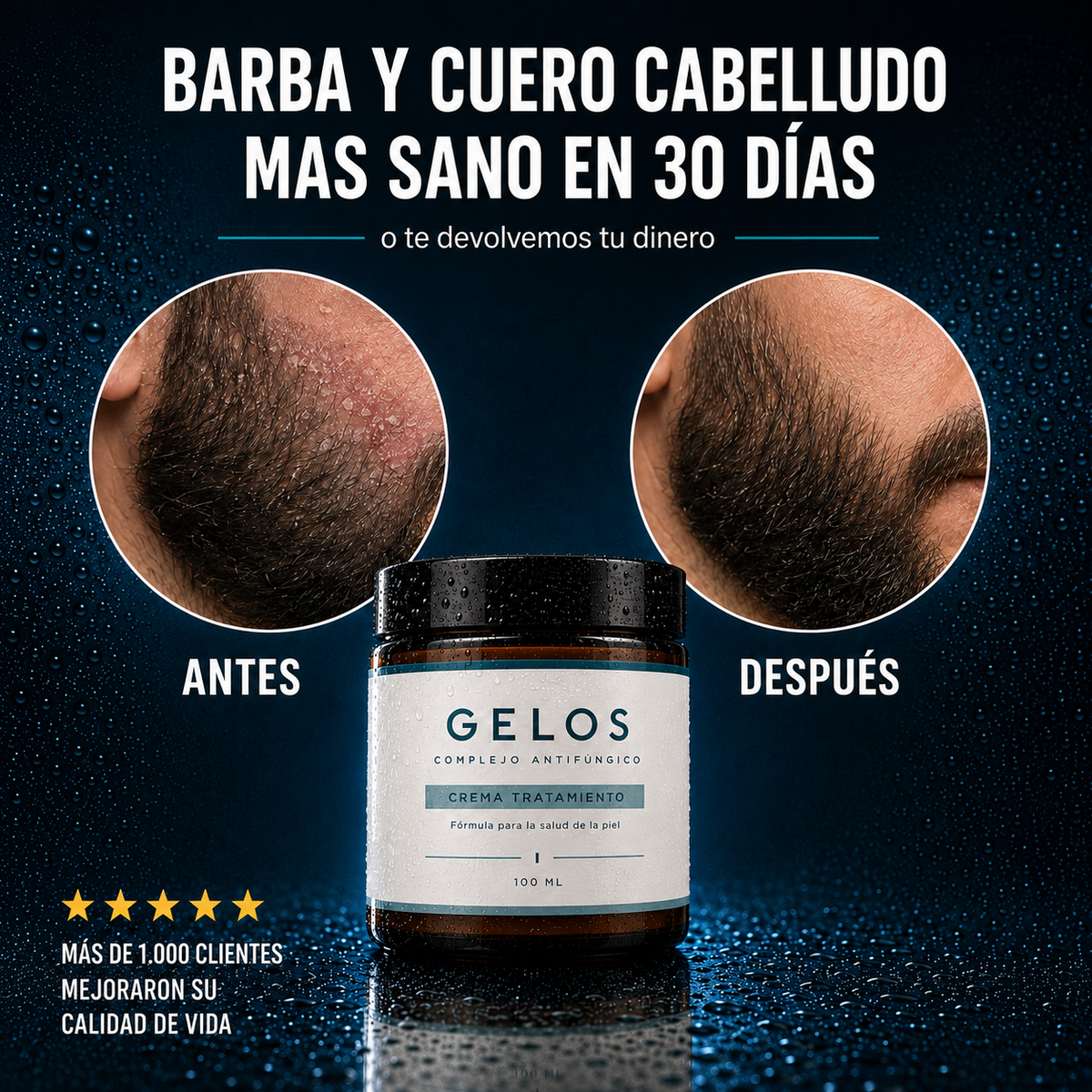 Gelos | Crema anticaspa y control dermatitis