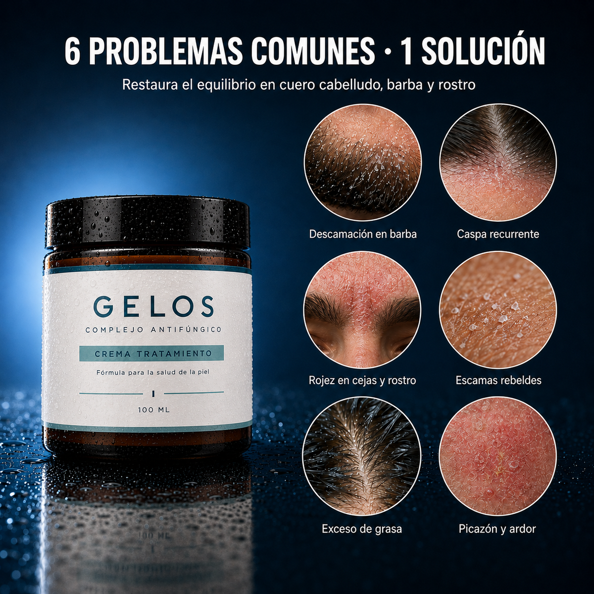 Gelos | Crema anticaspa y control dermatitis
